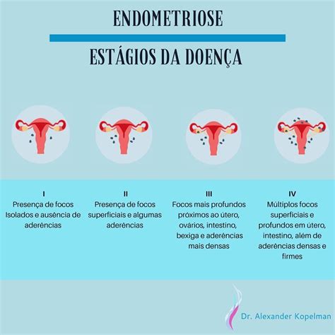 endometriose sintomas e tratamento